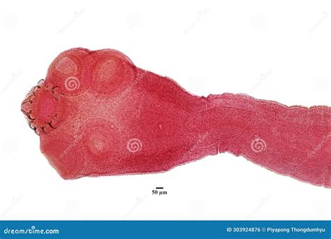 Tapeworms (Cestoda: Caryophyllidea), Parasites of Fish Under the ...