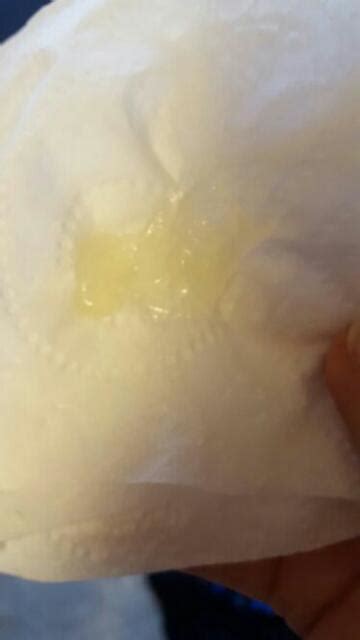 thick clear jelly like discharge - Captions Domestic