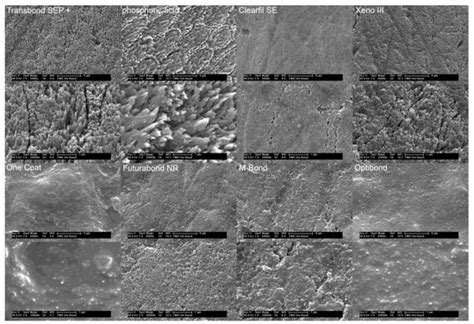 Etching Patterns of Self-Etching Primers in Relation to Shear Bond ...
