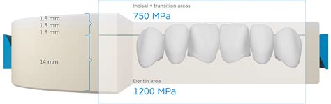 Cercon ht ML: Dental Zirconia | Dentsply Sirona IN