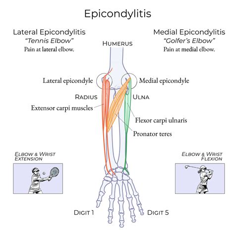 What Is The Medial Epicondyle Of The Humerus