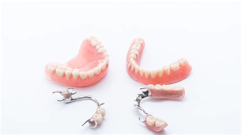 Fixed Partial Denture All Metal