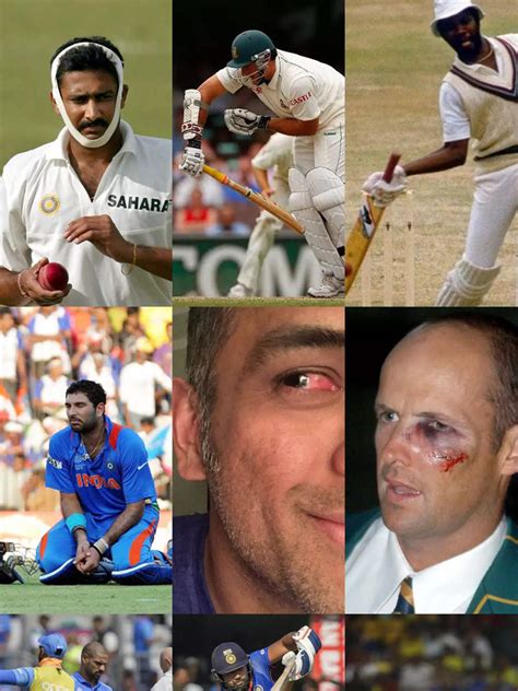 Cricketers who braved injuries to take the field | Times of India