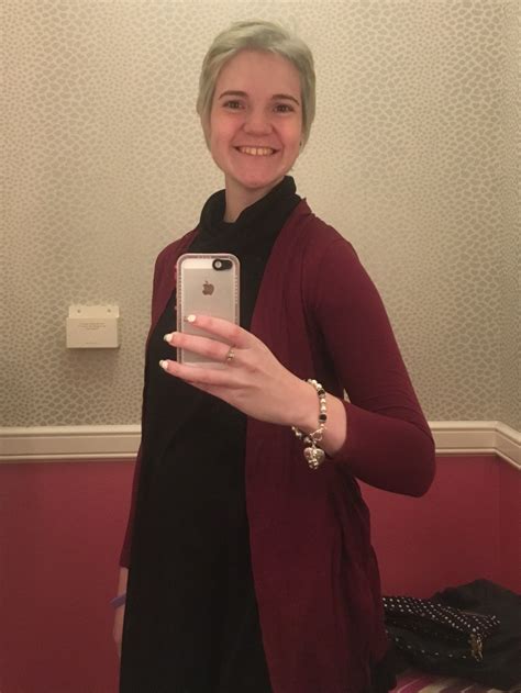 Anne Grace Glenn on Twitter: "Hormones, Hair Loss and Halloween https://t.co/pDFdaX4F4P https ...