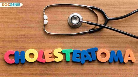 Cholesteatoma: Causes, Symptoms, and Diagnosis - DocGenie Blog