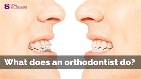 What does an orthodontist do? - Ewell Orthodontics