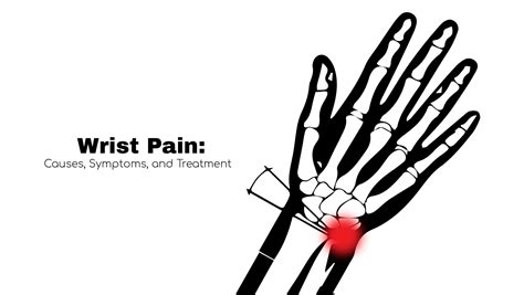 Left Hand Thumb Wrist Pain at Brian Durham blog