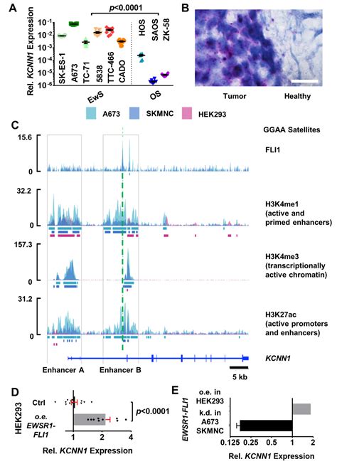 Relevance of Abnormal KCNN1 Expression and Osmotic Hypersensitivity in ...