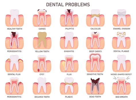 Problems With Teeth