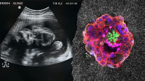 Watch: The Exact Moment A Human Embryo Implants In Real-Time