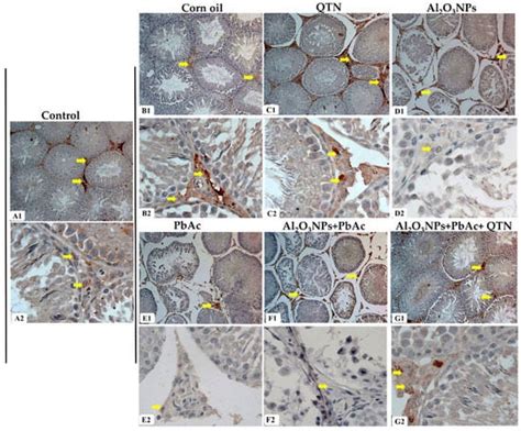 Quercetin Abates Aluminum Trioxide Nanoparticles and Lead Acetate ...