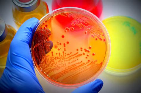 Infecciones por Escherichia coli: MedlinePlus en español