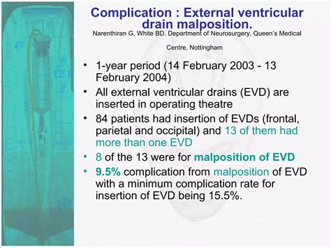 External Ventricular Drain | PPT