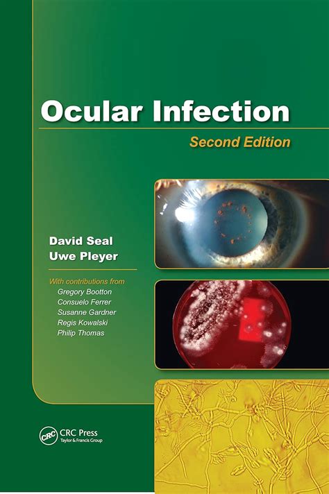 Buy Ocular Infection: Investigation and Treatment in Practice Book ...