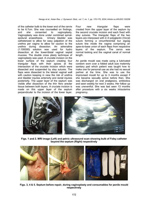 Innovative Use of Padded-Condom Penile Mould Post-vaginoplasty in Low Transverse Vaginal Septum ...