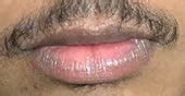 Buy Minimalist 8% L-Ascorbic Acid Lip Treatment Balm with Vitamin E ...