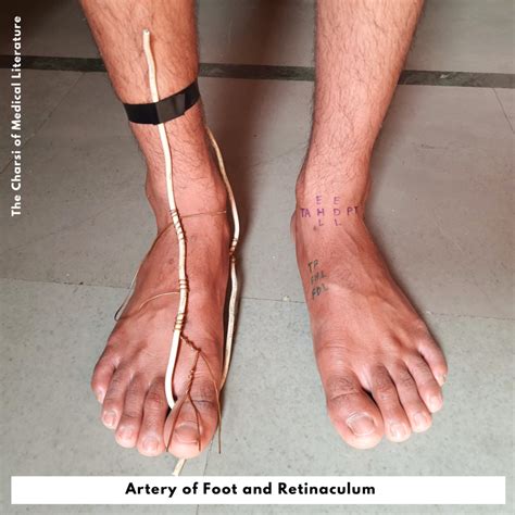 Dorsalis pedis artery - TCML - The Charsi of Medical Literature