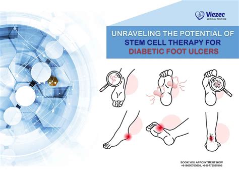 Potential Of Stem Cell Therapy For Diabetic Foot Ulcers