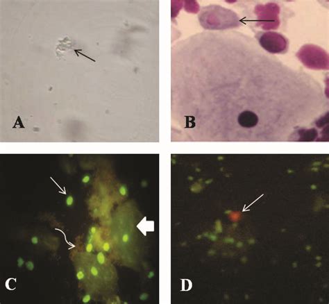 Trichomonas Vaginalis Wet Mount