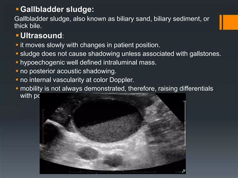 Gallbladder ultrasound (basic) | PPTX