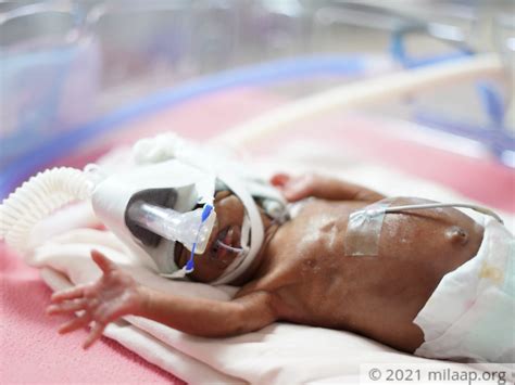 Baby At 29 Weeks Premature