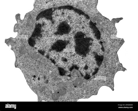 Transmission Electron Microscope Micrograph Galleries | Biological