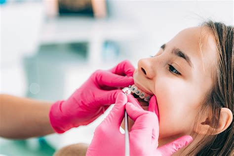 Orthodontist vs. Dentist: What's the difference? - Smart Dental Network