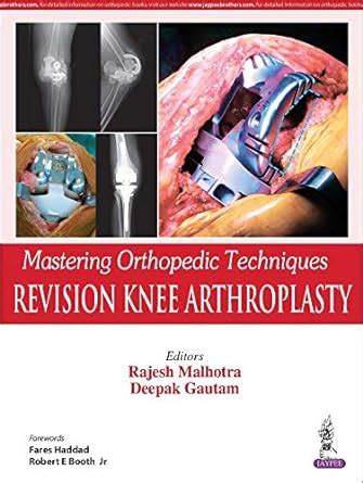 Buy Mastering Orthopedic Techniques Revision Knee Arthroplasty Book ...