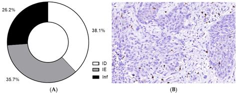 Immune Microenvironment of Muscular-Invasive Urothelial Carcinoma: The ...