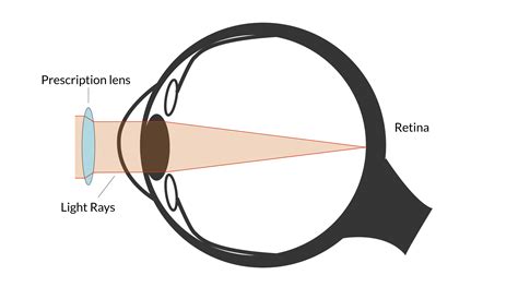How Do Glasses Work? | SmartBuyGlasses NZ