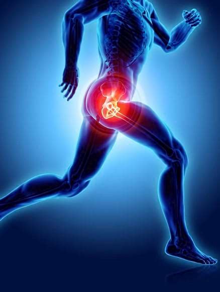 Robotic Hip Replacement Patna | Robotic Hip Replacement Surgery