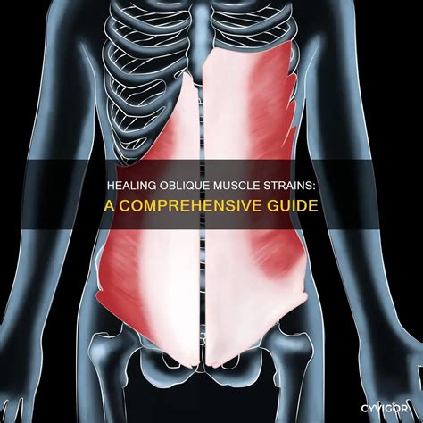 Healing Oblique Muscle Strains: A Comprehensive Guide | CyVigor