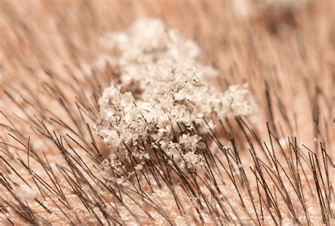 Help! My Dog Has Dry Flaky Skin and Scabs | PawLeaks