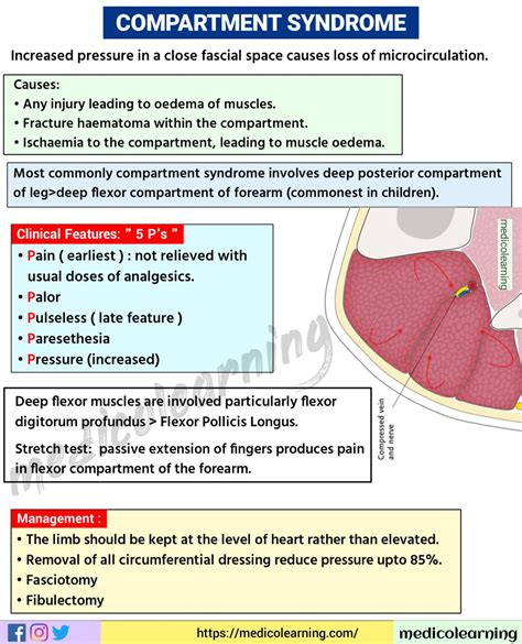 Compartment Syndrome – MedicoLearning