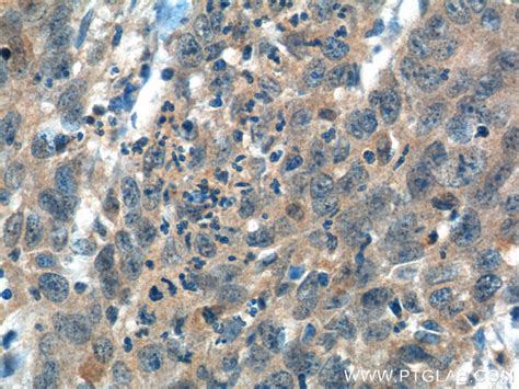 ITPKB antibody (12816-1-AP) | Proteintech