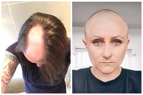 ‘Gambling stress made my hair fall out': Concerns cost of living crisis may plunge more into ...