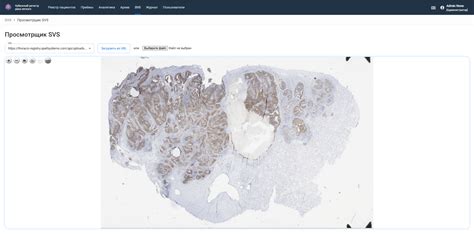 Oncology Medical Information System | SPELLSYSTEMS