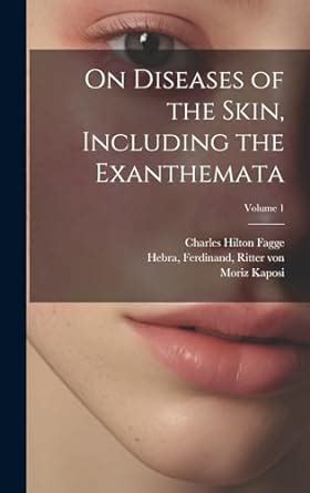 Buy On Diseases of the Skin, Including the Exanthemata; Volume 1 Book ...