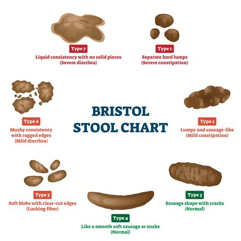 Irritable Bowel Movement - Bristol Stool Chart - Methodist Health System