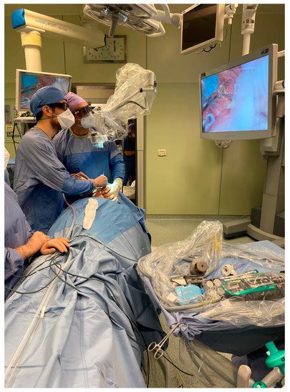 Hybrid Exoscopic and Robotic Transoral Removal of a Bilateral Hilar ...