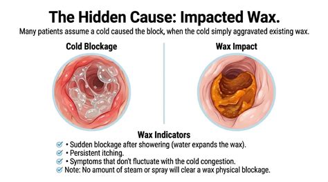Blocked Ears Due To Cold: Causes, Relief And Treatment | Dewaxify