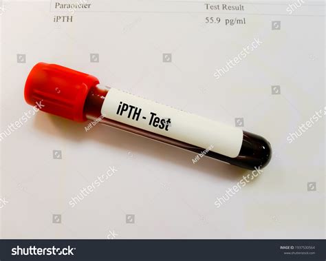 Blood Sample Intact Pth Ipth Test Stock Photo 1937530564 | Shutterstock