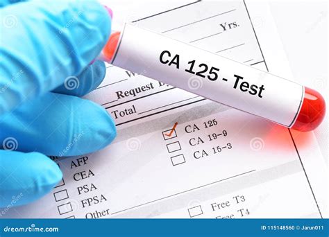 Blood Sample for CA125 Test Stock Photo - Image of research, experiment: 115148560
