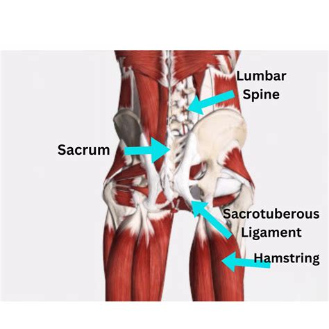 Sacrotuberous Ligament Pain