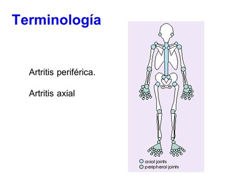 Dolor Articular y Artritis - ppt video online descargar