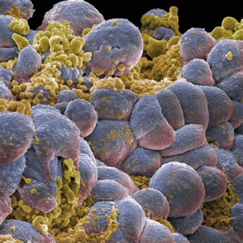 Human Estrogen Receptor Alpha from target database | PDTDB ...