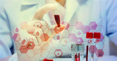 Types Classical Biotechnology 的图像结果