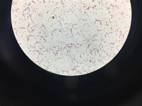 Spore Stain