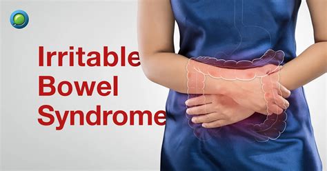 What is Irritable Bowel Syndrome? - FAQs