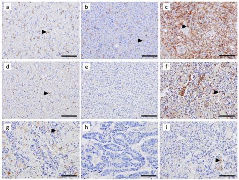 Complement Activation and Up-Regulated Expression of Anaphylatoxin C3a ...